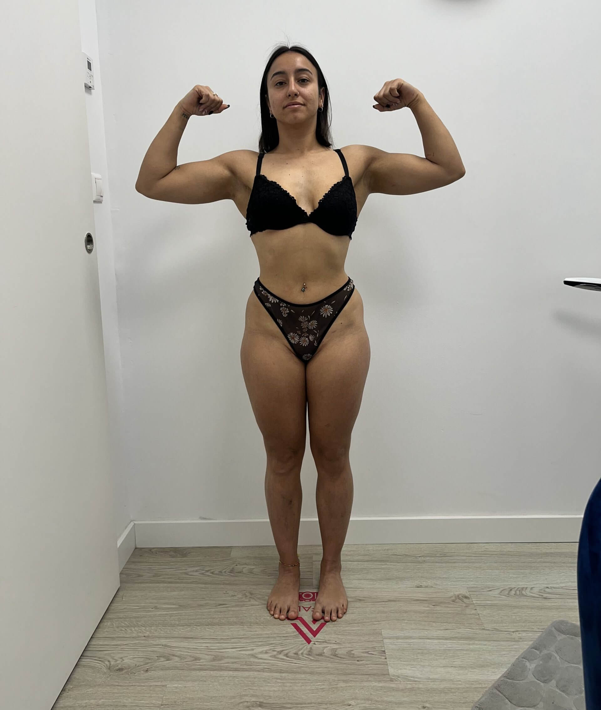 Después de la transformación con Al Fallo Nutrition — caso 1